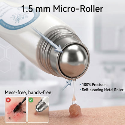 🍲 Official Store | Healrize® 🖊 Skin Tag & Spot Remover in 7 Days (Zero Pain, Zero Scarring – Precise Roller) 👩
