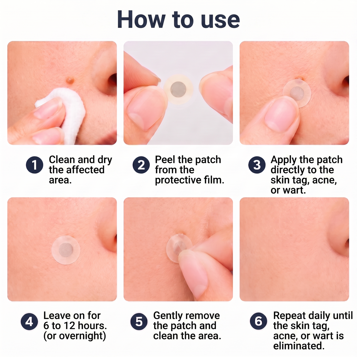 ✅🇦🇺𝐇𝐞𝒂𝒍𝗿𝗶𝙯𝙚®2-in-1 Microneedle & Hydrocolloid Patch🛤️| Removes Raised Moles, Acne, Flat Warts & Skin Tags | Helps Improve Wrinkles, Scars & Blemishes | Invisible Patches for Face & Body（副本）