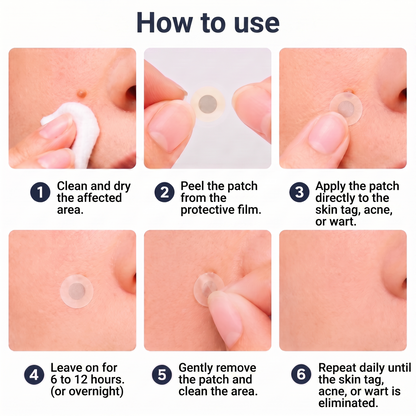✅🇦🇺𝐇𝐞𝒂𝒍𝗿𝗶𝙯𝙚®2-in-1 Microneedle & Hydrocolloid Patch🛤️| Removes Raised Moles, Acne, Flat Warts & Skin Tags | Helps Improve Wrinkles, Scars & Blemishes | Invisible Patches for Face & Body（副本）