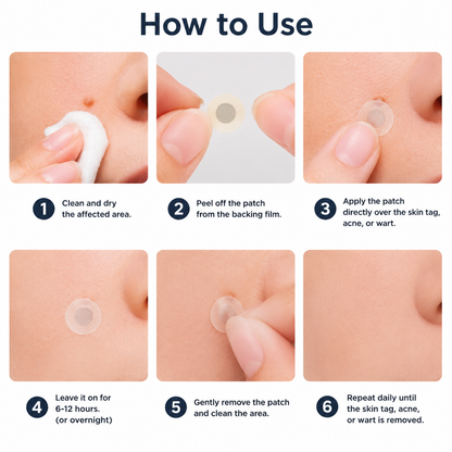✅🇦🇺𝐇𝐞𝒂𝒍𝗿𝗶𝙯𝙚®2-in-1 Microneedle & Hydrocolloid Patch💫| Removes Raised Moles, Acne, Flat Warts & Skin Tags | Helps Improve Wrinkles, Scars & Blemishes | Invisible Patches for Face & Body